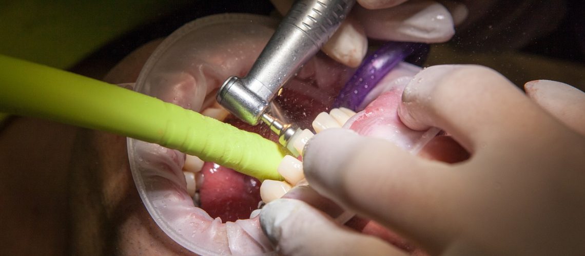 operation facet gloves teeth grind dentist health